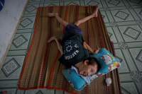 Child with Cerebral Palsy in Dinh Quan District